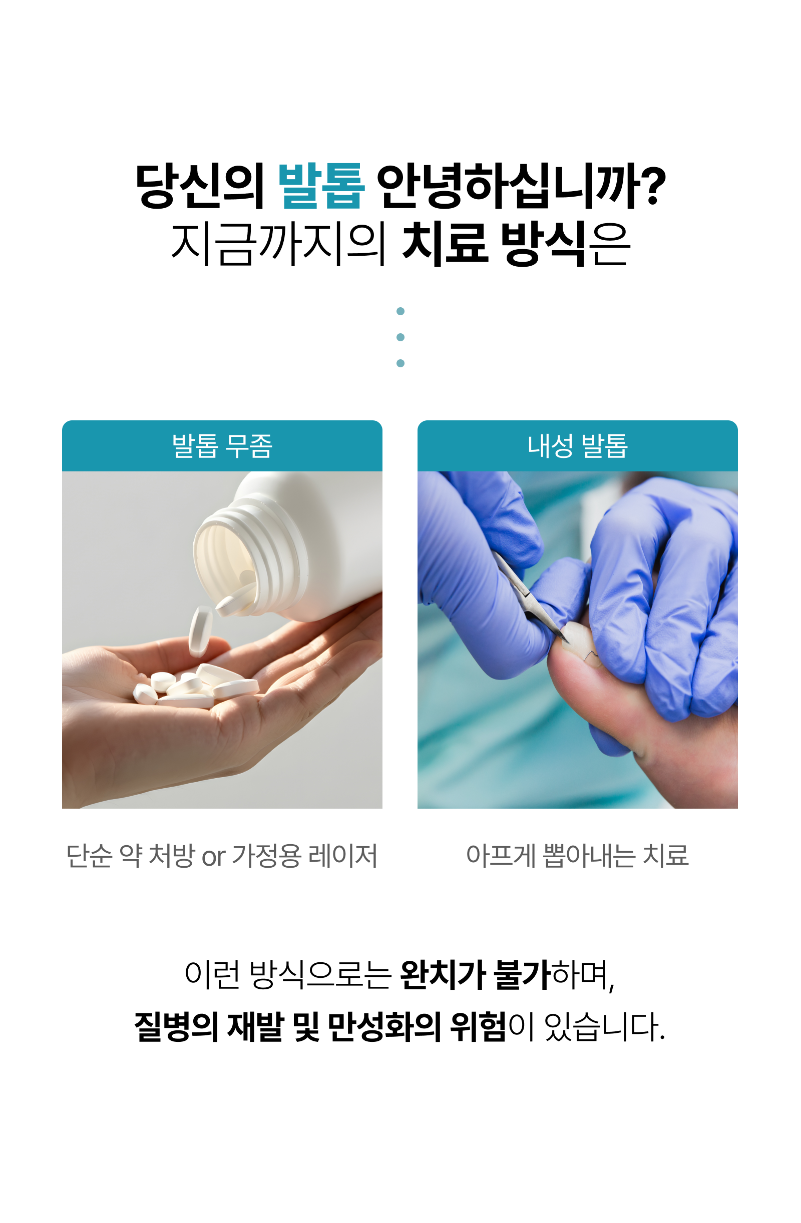 르샤인의원 문제성 발톱 클리닉