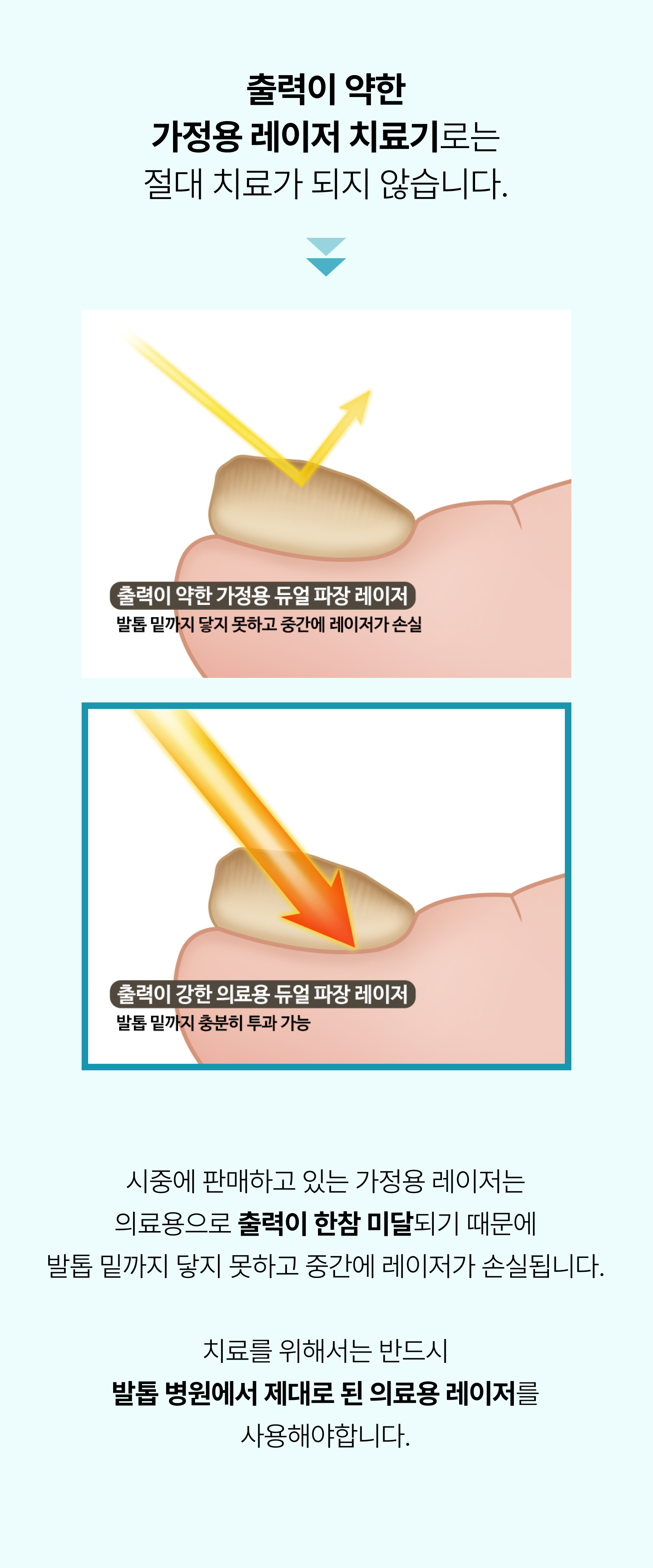 르샤인의원 문제성 발톱 클리닉